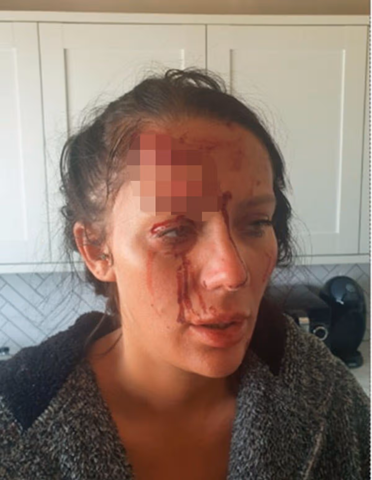 Kiena suffered significant injuries after she was assaulted by Wellings on July 11 2022