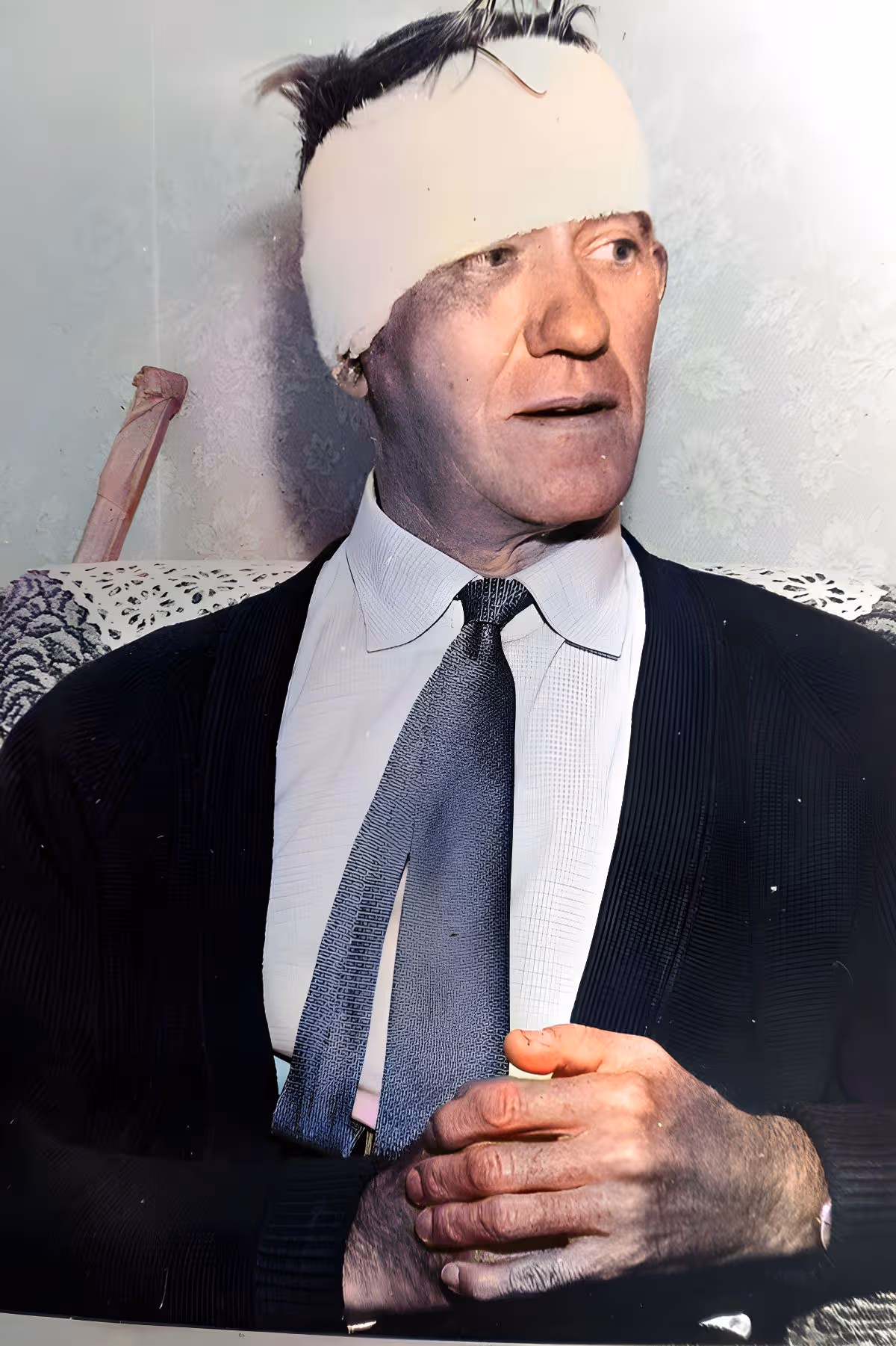 Train driver Jack Mills with a bandage wrapped round his head