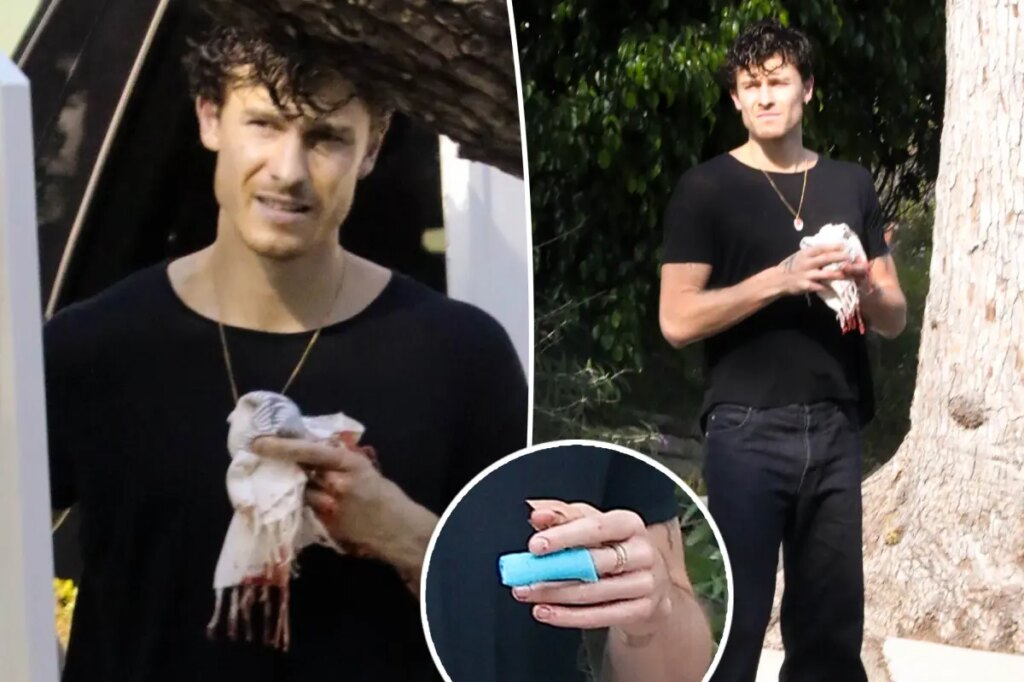 shawn-mendes-finger-injury.jpg