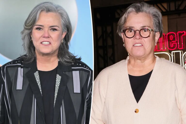 rosie-o-donnell-secret-facelift.jpg